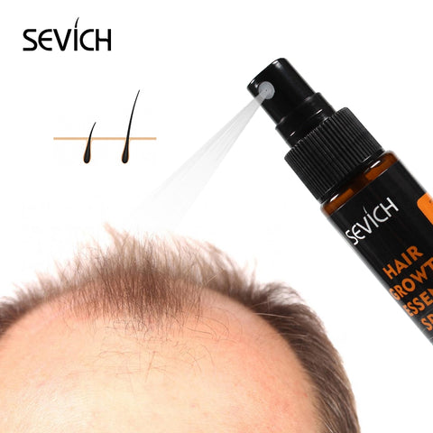Hebal Essence Hair Growth Spray for Hair Loss Treatment